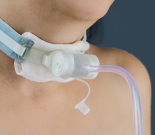 Tracheostomy training